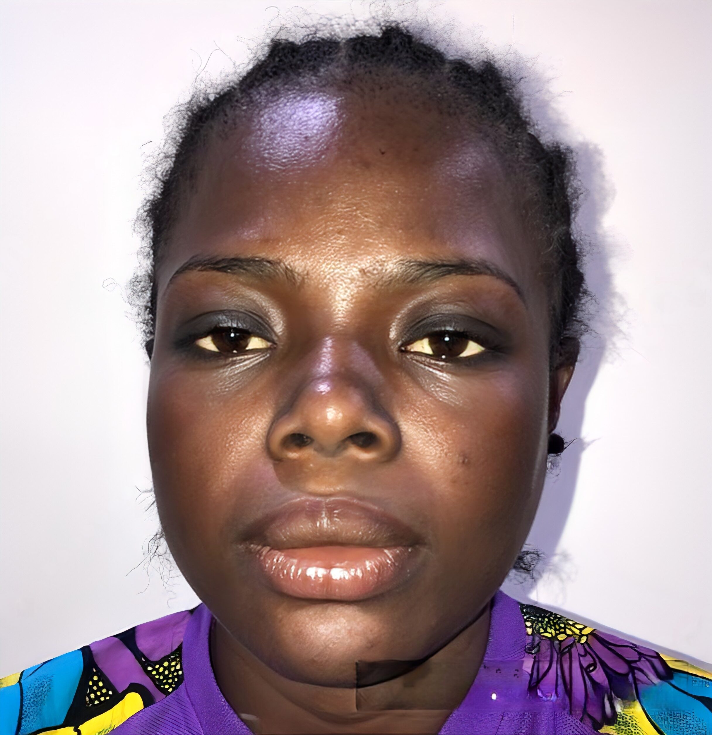 wmremove transformed